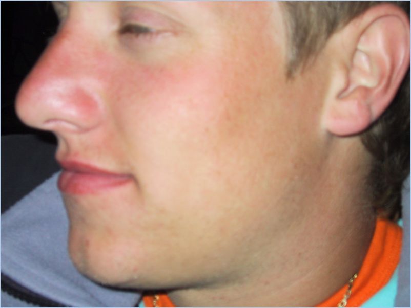 Bonndilten 2004 057